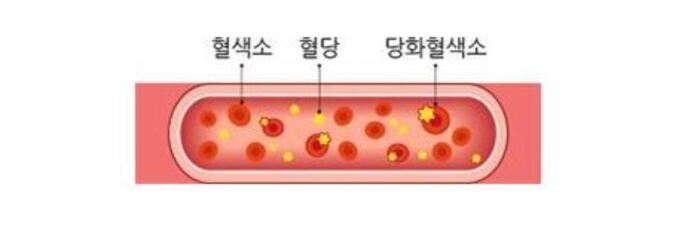 당화혈색소 정상수치는 건강지표 당화혈색소 낮추기